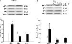 Estrogen Receptor beta Antibody in Western Blot (WB)