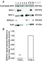 SERCA1 ATPase Antibody in Western Blot (WB)