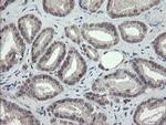 TLE1 Antibody in Immunohistochemistry (Paraffin) (IHC (P))
