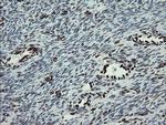 TLE1 Antibody in Immunohistochemistry (Paraffin) (IHC (P))