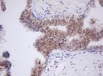 TLE1 Antibody in Immunohistochemistry (Paraffin) (IHC (P))