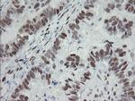 TLE1 Antibody in Immunohistochemistry (Paraffin) (IHC (P))