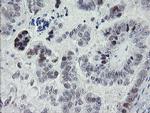 TLE1 Antibody in Immunohistochemistry (Paraffin) (IHC (P))