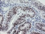 TLE1 Antibody in Immunohistochemistry (Paraffin) (IHC (P))