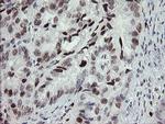 TLE1 Antibody in Immunohistochemistry (Paraffin) (IHC (P))