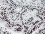 TLE1 Antibody in Immunohistochemistry (Paraffin) (IHC (P))