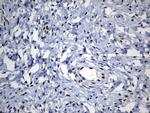 TLE1 Antibody in Immunohistochemistry (Paraffin) (IHC (P))
