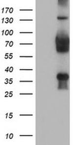 TLE2 Antibody in Western Blot (WB)