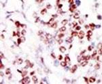 TLK1 Antibody in Immunohistochemistry (IHC)