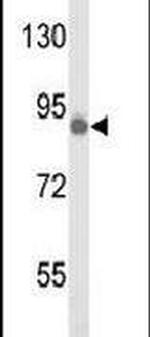 TLK1 Antibody in Western Blot (WB)