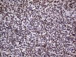 TLK2 Antibody in Immunohistochemistry (Paraffin) (IHC (P))