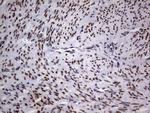TLK2 Antibody in Immunohistochemistry (Paraffin) (IHC (P))