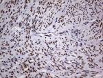 TLK2 Antibody in Immunohistochemistry (Paraffin) (IHC (P))