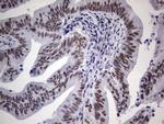 TLK2 Antibody in Immunohistochemistry (Paraffin) (IHC (P))