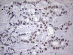 TLK2 Antibody in Immunohistochemistry (Paraffin) (IHC (P))