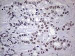 TLK2 Antibody in Immunohistochemistry (Paraffin) (IHC (P))