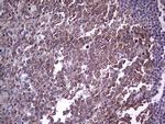 TLK2 Antibody in Immunohistochemistry (Paraffin) (IHC (P))