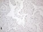 TLK2 Antibody in Immunohistochemistry (Paraffin) (IHC (P))