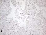 TLK2 Antibody in Immunohistochemistry (Paraffin) (IHC (P))