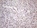 TLK2 Antibody in Immunohistochemistry (Paraffin) (IHC (P))