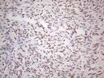TLK2 Antibody in Immunohistochemistry (Paraffin) (IHC (P))