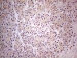 TLK2 Antibody in Immunohistochemistry (Paraffin) (IHC (P))
