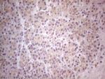 TLK2 Antibody in Immunohistochemistry (Paraffin) (IHC (P))