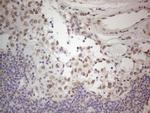 TLK2 Antibody in Immunohistochemistry (Paraffin) (IHC (P))