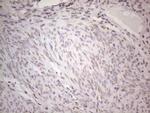 TLK2 Antibody in Immunohistochemistry (Paraffin) (IHC (P))