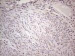 TLK2 Antibody in Immunohistochemistry (Paraffin) (IHC (P))