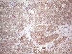 TLK2 Antibody in Immunohistochemistry (Paraffin) (IHC (P))