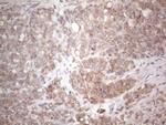 TLK2 Antibody in Immunohistochemistry (Paraffin) (IHC (P))
