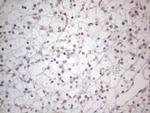 TLK2 Antibody in Immunohistochemistry (Paraffin) (IHC (P))