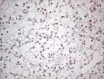 TLK2 Antibody in Immunohistochemistry (Paraffin) (IHC (P))