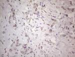TLK2 Antibody in Immunohistochemistry (Paraffin) (IHC (P))