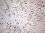 TLK2 Antibody in Immunohistochemistry (Paraffin) (IHC (P))