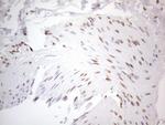 TLK2 Antibody in Immunohistochemistry (Paraffin) (IHC (P))