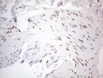 TLK2 Antibody in Immunohistochemistry (Paraffin) (IHC (P))