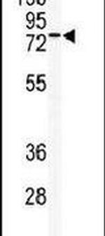 TLK2 Antibody in Western Blot (WB)
