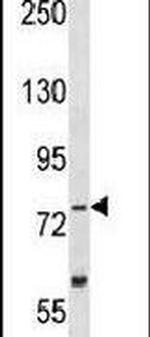 TLK2 Antibody in Western Blot (WB)