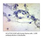 TLR1 Antibody in Immunohistochemistry (IHC)