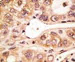 TLR5 Antibody in Immunohistochemistry (IHC)