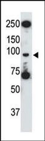 TLR5 Antibody in Western Blot (WB)