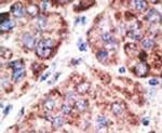 TLR6 Antibody in Immunohistochemistry (IHC)
