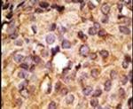 TLR6 Antibody in Immunohistochemistry (IHC)