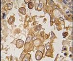 TLR6 Antibody in Immunohistochemistry (IHC)