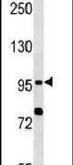 TLR6 Antibody in Western Blot (WB)