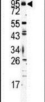 TLR6 Antibody in Western Blot (WB)