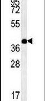 TM111 Antibody in Western Blot (WB)