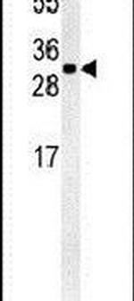 TM2D3 Antibody in Western Blot (WB)